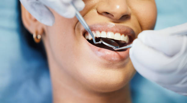 Best Emergency Dental Care for Abscessed Tooth in New Castle, PA