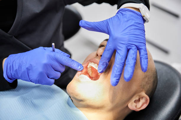 Best Broken or Cracked Tooth Emergency Dentist in New Castle, PA