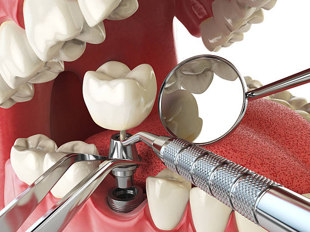 Best Orthodontic Emergency Dentist in New Castle, PA